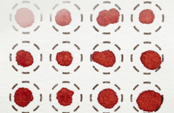 Dried blood spots on a fiber filter for laboratory analysis